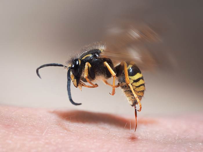 Eine Wespe sticht in die Haut